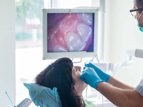 Intraoral Cameras