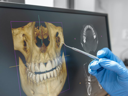 CBCT Cone Beam Technology