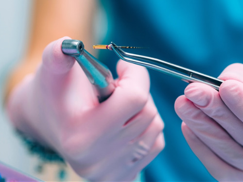 Rotary Endodontics